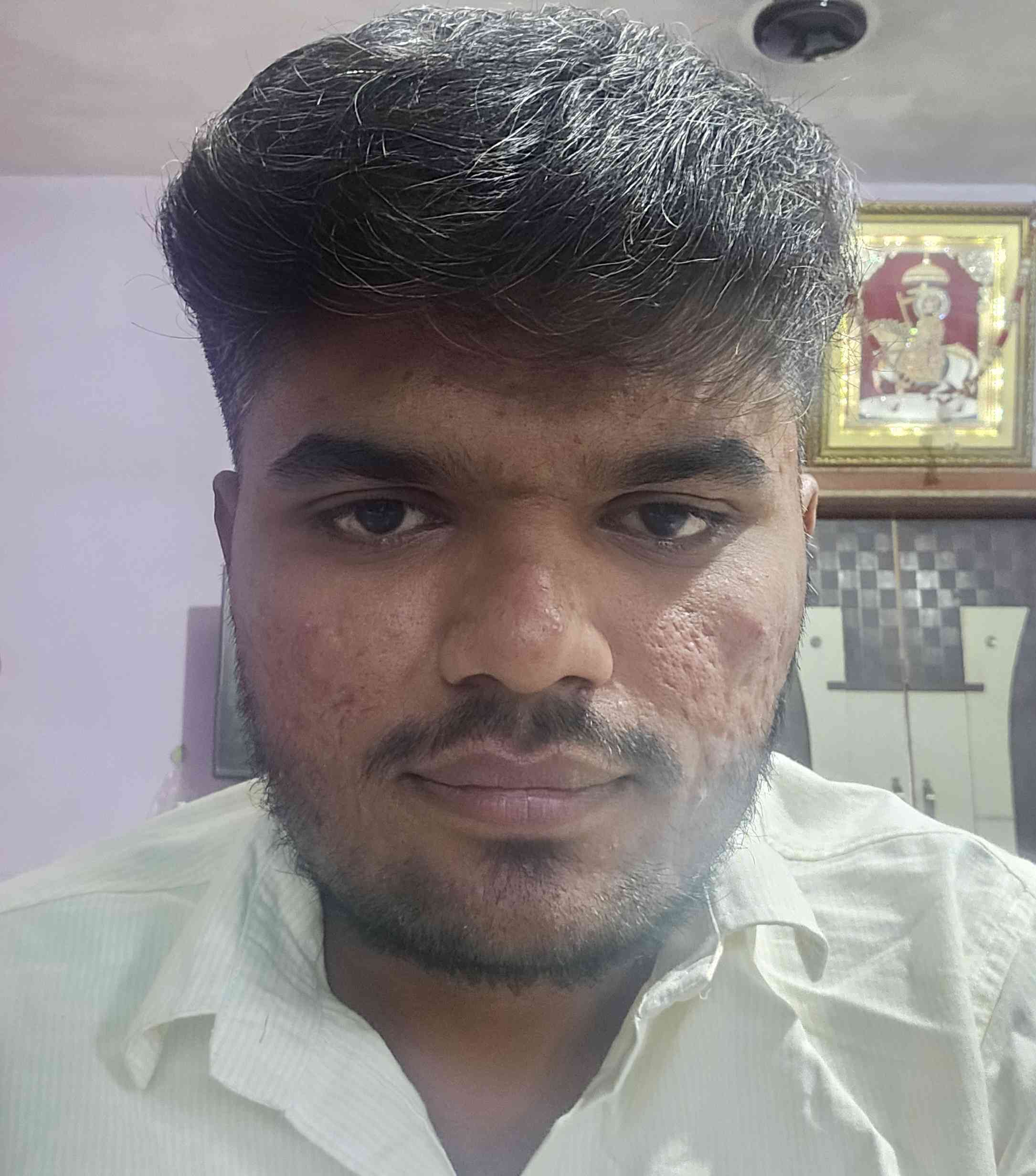 Vinay parmar